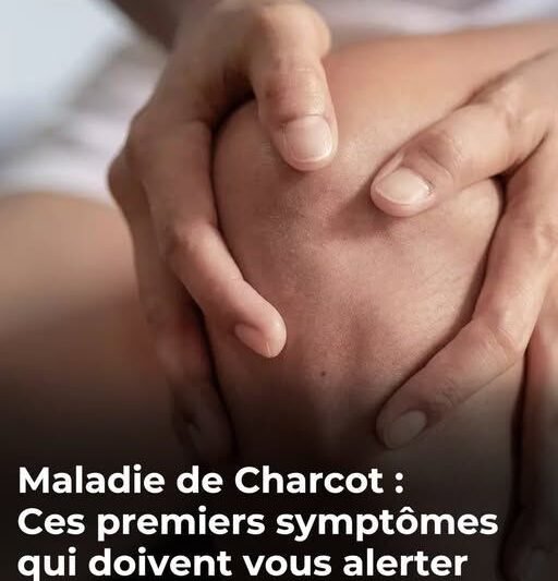 Charcot’s Disease (ALS): Recognizing the Early Warning Signs