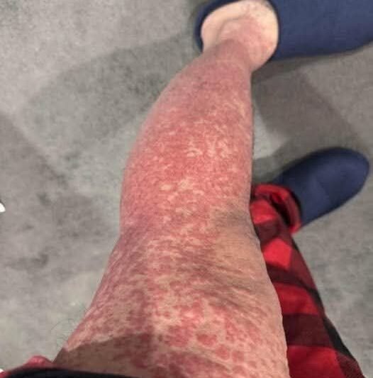 Here are the consequences of sleeping with … Learn more.